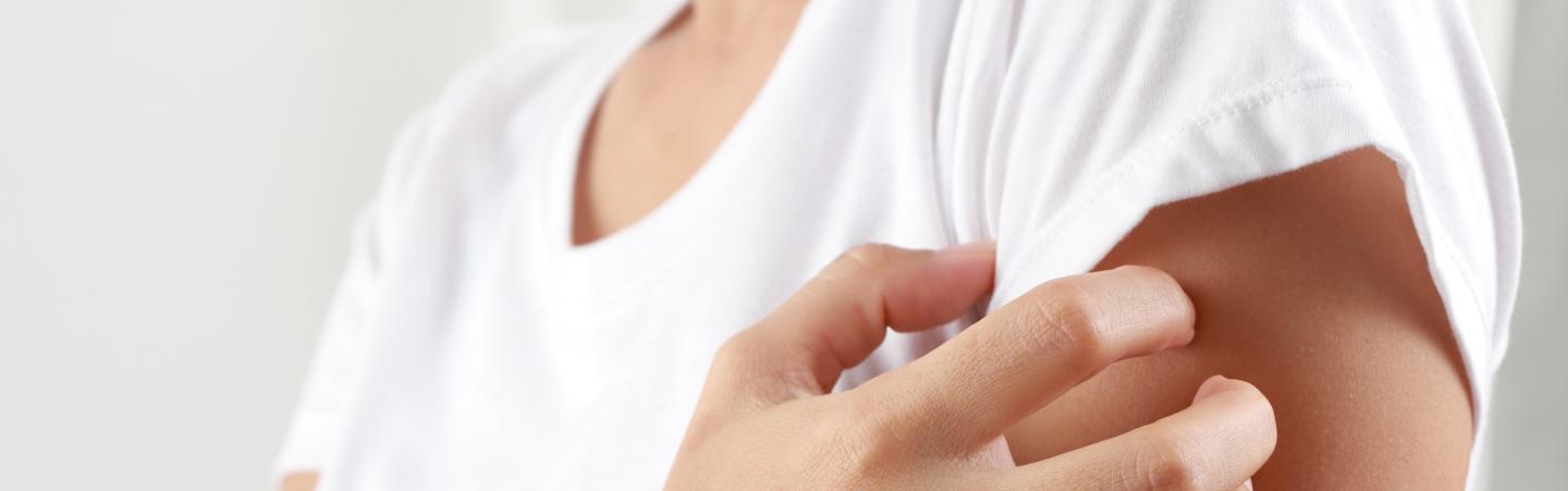 Woman scratching arm